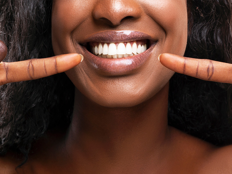Happy woman with bright smile showcasing teeth whitening product.