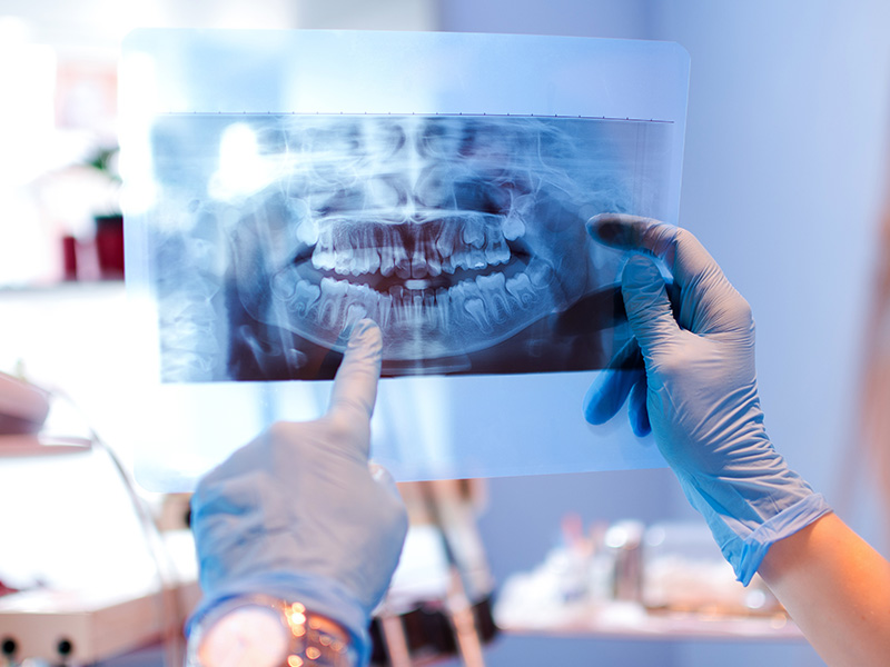 An individual in a medical setting is using a magnifying glass to examine a dental X-ray.